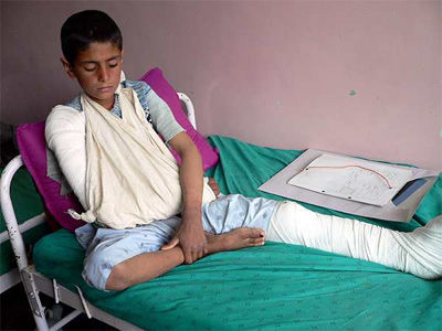 Una niño afgano que resultó herido durante el bombardeo de la fuerza de la OTAN en la provincia sureña de Daykundi el pasado domingo. - EFE