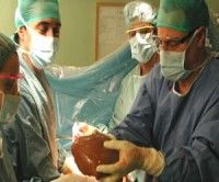 Aumentan trasplantes de órganos en el mundo en 2010