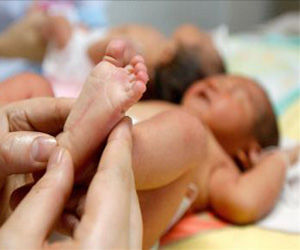 Más de 15 millones de niños nacen prematuramente cada año en el mundo
