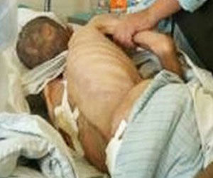Pacientes eran cuidados en precarias condiciones de sanidad