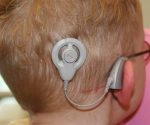 La neuroprótesis sonora permite que niños con sordera profunda, de origen coclear, desarrollen el lenguaje oral.